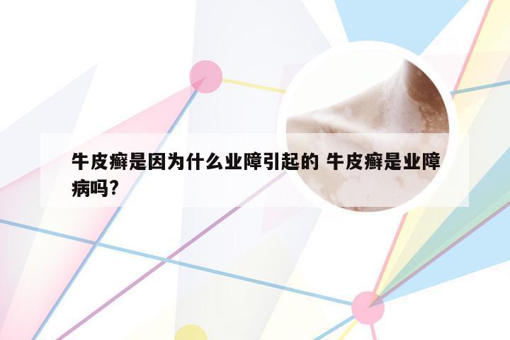 牛皮癣是因为什么业障引起的 牛皮癣是业障病吗?