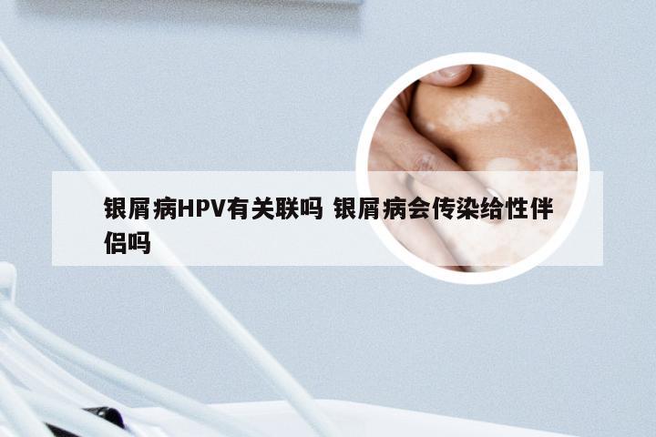 银屑病HPV有关联吗 银屑病会传染给性伴侣吗