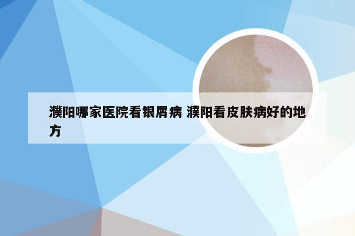 濮阳哪家医院看银屑病 濮阳看皮肤病好的地方
