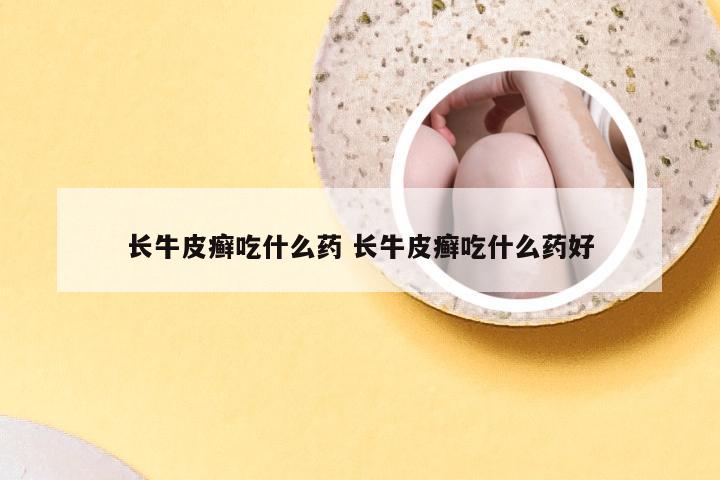 长牛皮癣吃什么药 长牛皮癣吃什么药好