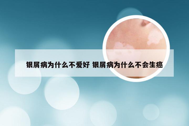 银屑病为什么不爱好 银屑病为什么不会生癌