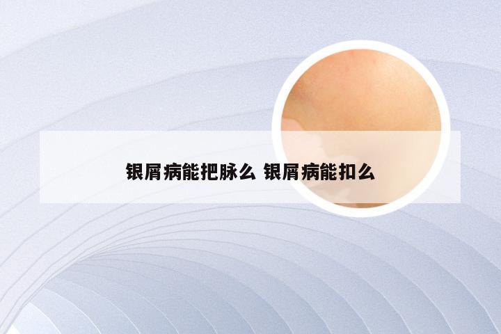 银屑病能把脉么 银屑病能扣么