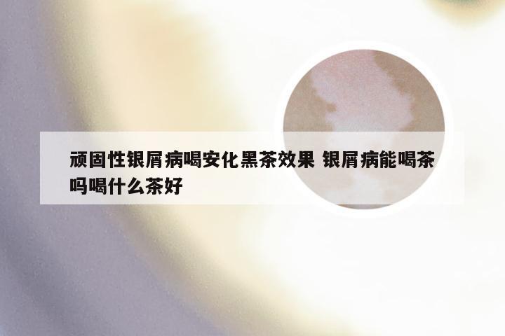 顽固性银屑病喝安化黑茶效果 银屑病能喝茶吗喝什么茶好