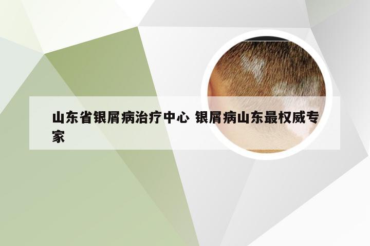 山东省银屑病治疗中心 银屑病山东最权威专家