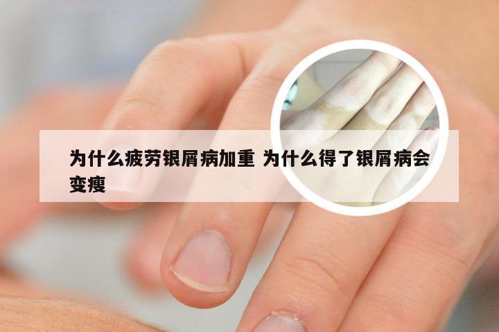 为什么疲劳银屑病加重 为什么得了银屑病会变瘦
