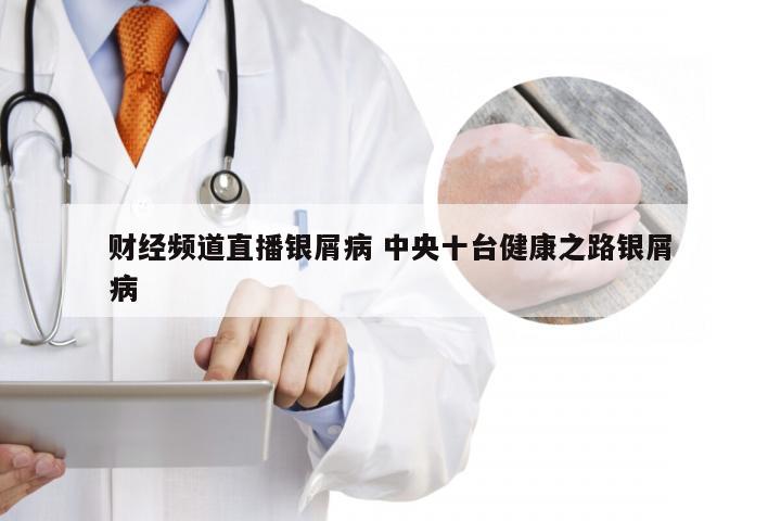 财经频道直播银屑病 中央十台健康之路银屑病