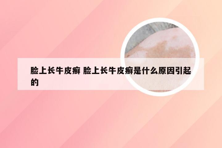 脸上长牛皮癣 脸上长牛皮癣是什么原因引起的