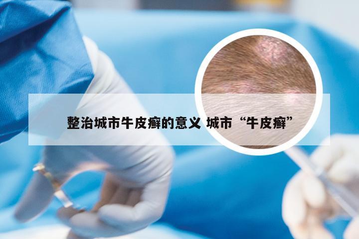 整治城市牛皮癣的意义 城市“牛皮癣”