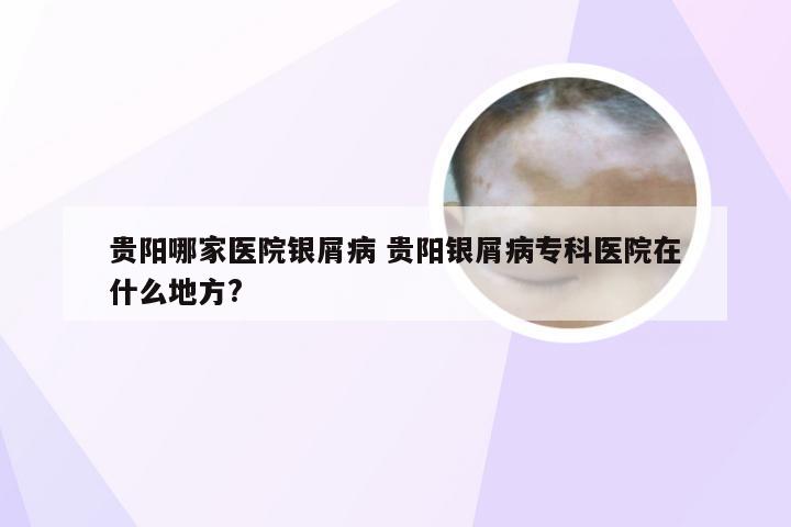 贵阳哪家医院银屑病 贵阳银屑病专科医院在什么地方?