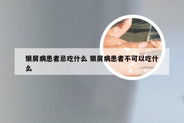 银屑病患者忌吃什么 银屑病患者不可以吃什么