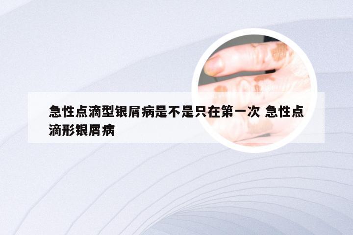 急性点滴型银屑病是不是只在第一次 急性点滴形银屑病