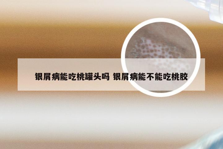 银屑病能吃桃罐头吗 银屑病能不能吃桃胶