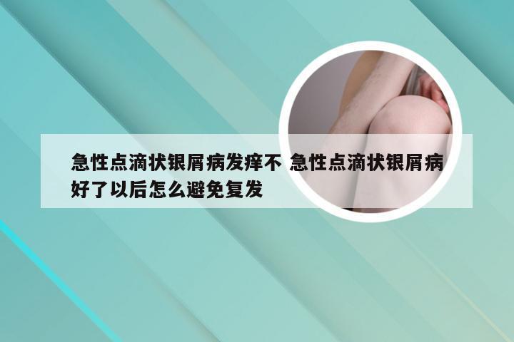 急性点滴状银屑病发痒不 急性点滴状银屑病好了以后怎么避免复发