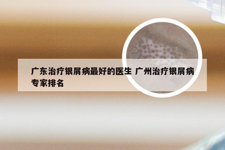 广东治疗银屑病最好的医生 广州治疗银屑病专家排名