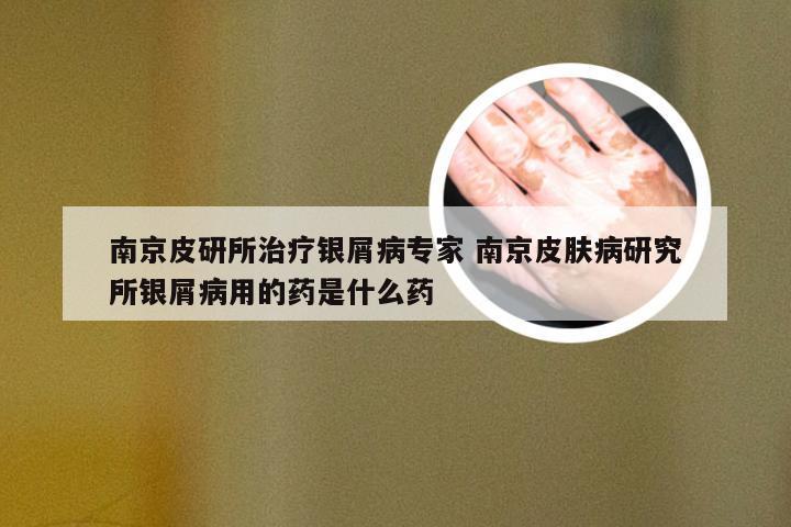 南京皮研所治疗银屑病专家 南京皮肤病研究所银屑病用的药是什么药
