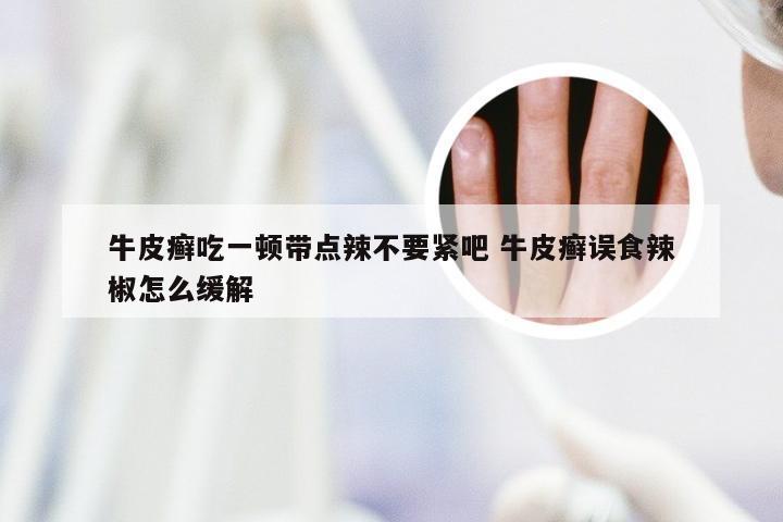 牛皮癣吃一顿带点辣不要紧吧 牛皮癣误食辣椒怎么缓解