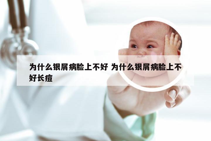 为什么银屑病脸上不好 为什么银屑病脸上不好长痘