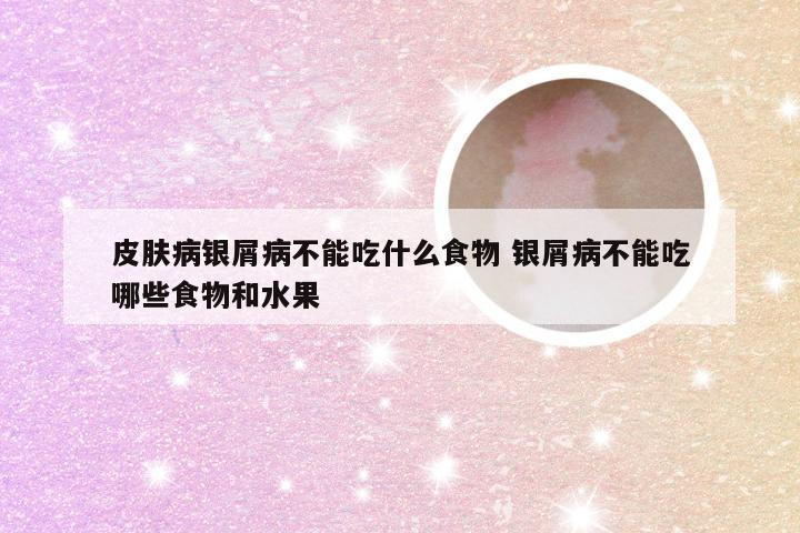 皮肤病银屑病不能吃什么食物 银屑病不能吃哪些食物和水果