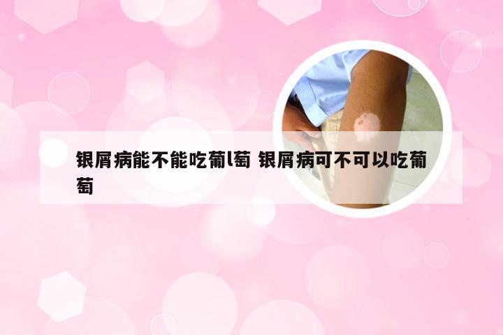 银屑病能不能吃葡l萄 银屑病可不可以吃葡萄