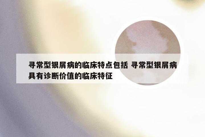 寻常型银屑病的临床特点包括 寻常型银屑病具有诊断价值的临床特征