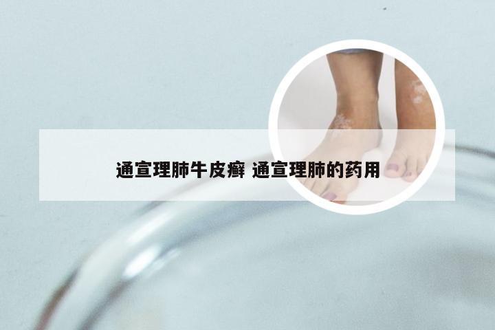 通宣理肺牛皮癣 通宣理肺的药用