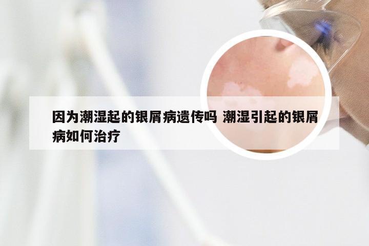 因为潮湿起的银屑病遗传吗 潮湿引起的银屑病如何治疗