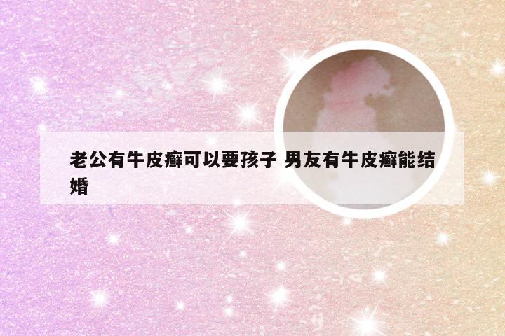 老公有牛皮癣可以要孩子 男友有牛皮癣能结婚