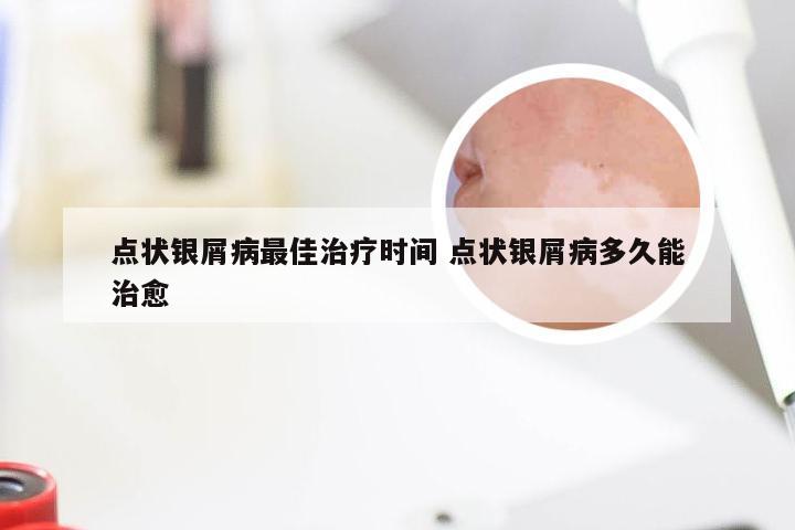 点状银屑病最佳治疗时间 点状银屑病多久能治愈