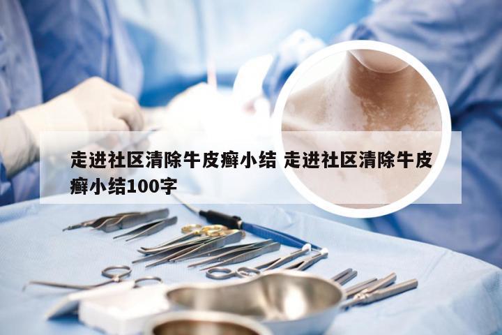 走进社区清除牛皮癣小结 走进社区清除牛皮癣小结100字