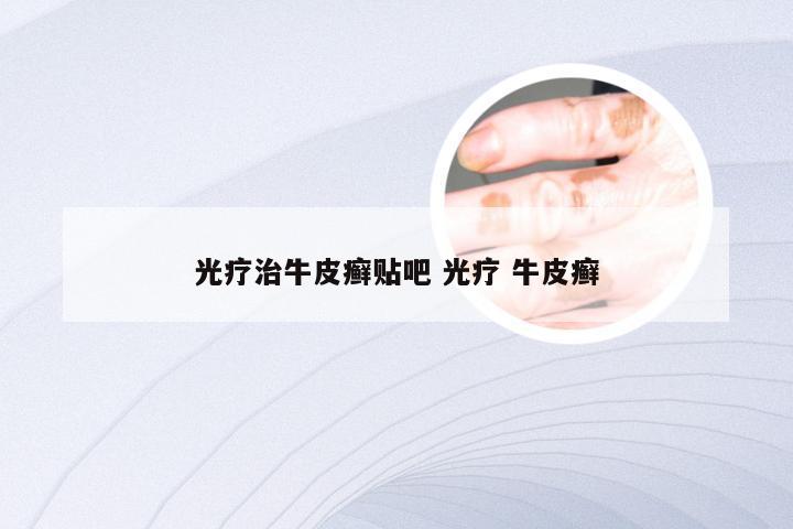 光疗治牛皮癣贴吧 光疗 牛皮癣