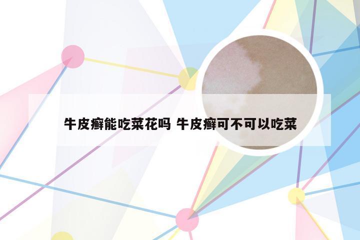 牛皮癣能吃菜花吗 牛皮癣可不可以吃菜