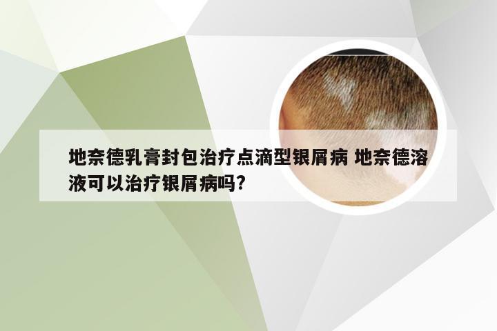 地奈德乳膏封包治疗点滴型银屑病 地奈德溶液可以治疗银屑病吗?