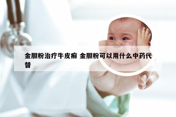 金胆粉治疗牛皮癣 金胆粉可以用什么中药代替