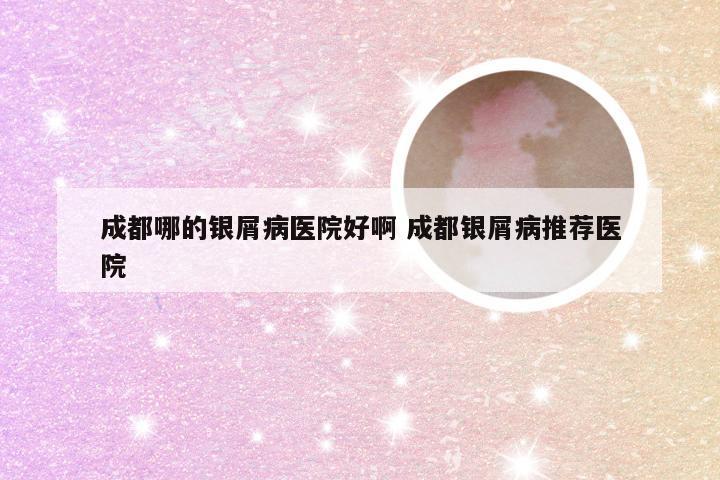 成都哪的银屑病医院好啊 成都银屑病推荐医院
