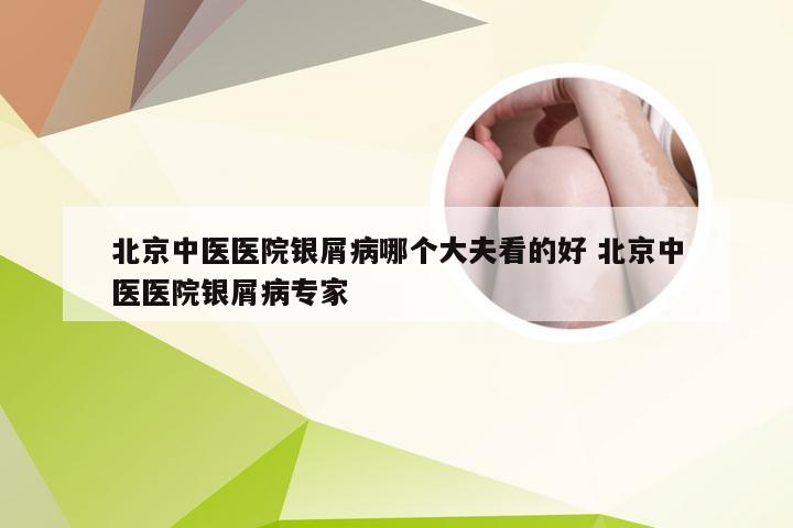 北京中医医院银屑病哪个大夫看的好 北京中医医院银屑病专家