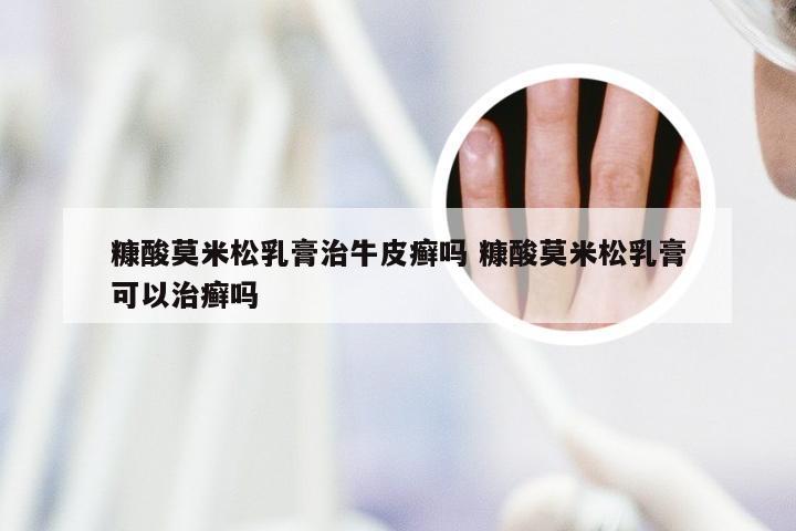 糠酸莫米松乳膏治牛皮癣吗 糠酸莫米松乳膏可以治癣吗