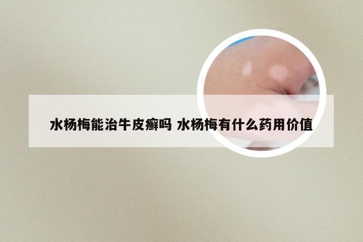 水杨梅能治牛皮癣吗 水杨梅有什么药用价值
