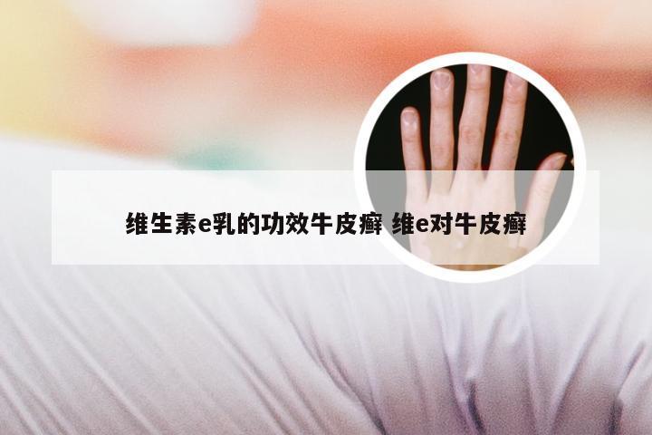 维生素e乳的功效牛皮癣 维e对牛皮癣