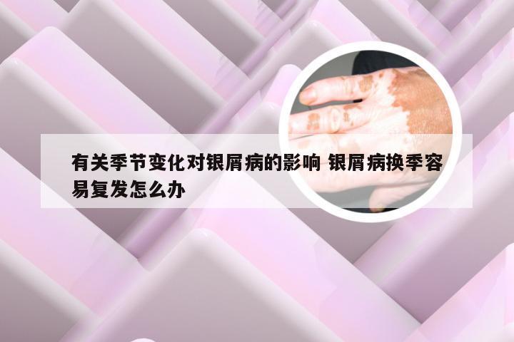 有关季节变化对银屑病的影响 银屑病换季容易复发怎么办