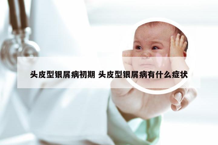 头皮型银屑病初期 头皮型银屑病有什么症状