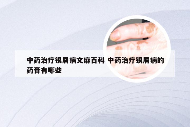 中药治疗银屑病文麻百科 中药治疗银屑病的药膏有哪些