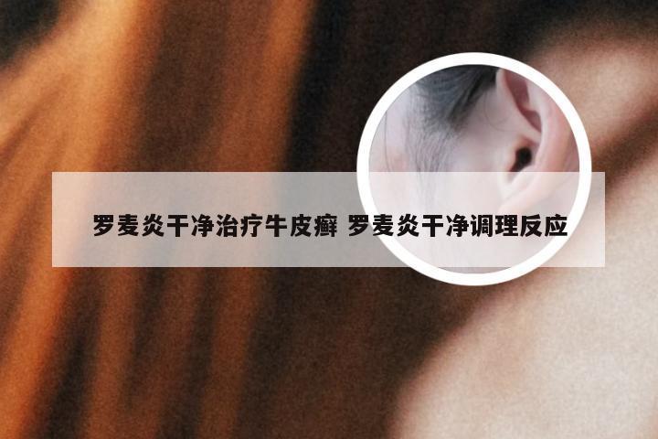 罗麦炎干净治疗牛皮癣 罗麦炎干净调理反应
