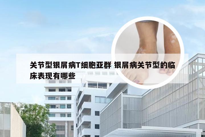 关节型银屑病T细胞亚群 银屑病关节型的临床表现有哪些