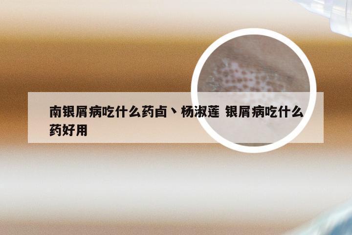 南银屑病吃什么药卣丶杨淑莲 银屑病吃什么药好用