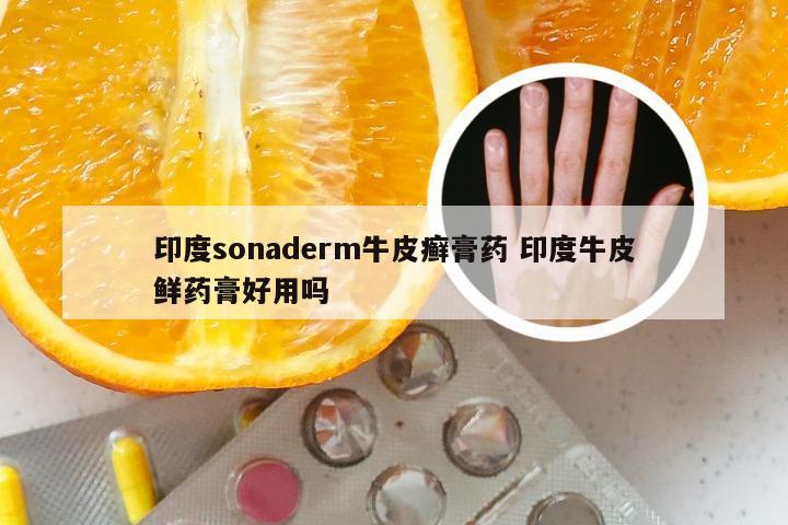 印度sonaderm牛皮癣膏药 印度牛皮鲜药膏好用吗