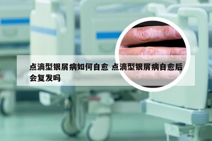 点滴型银屑病如何自愈 点滴型银屑病自愈后会复发吗