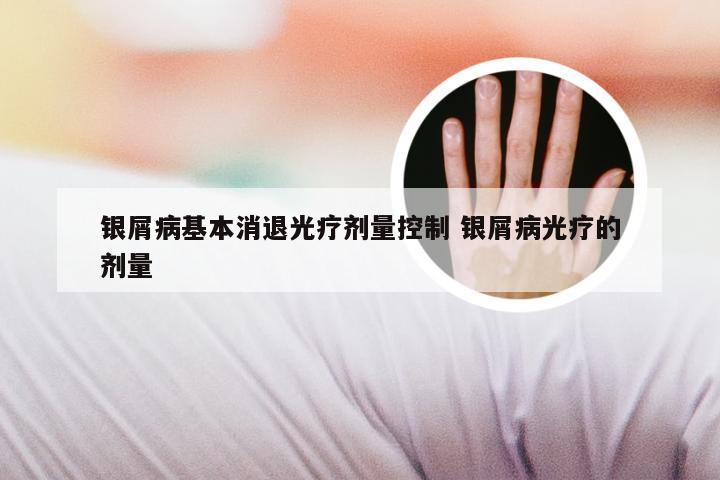 银屑病基本消退光疗剂量控制 银屑病光疗的剂量