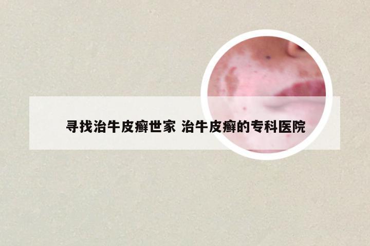 寻找治牛皮癣世家 治牛皮癣的专科医院