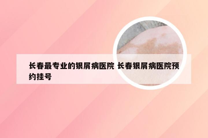 长春最专业的银屑病医院 长春银屑病医院预约挂号