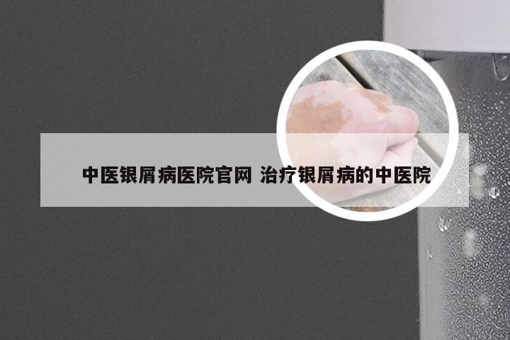中医银屑病医院官网 治疗银屑病的中医院